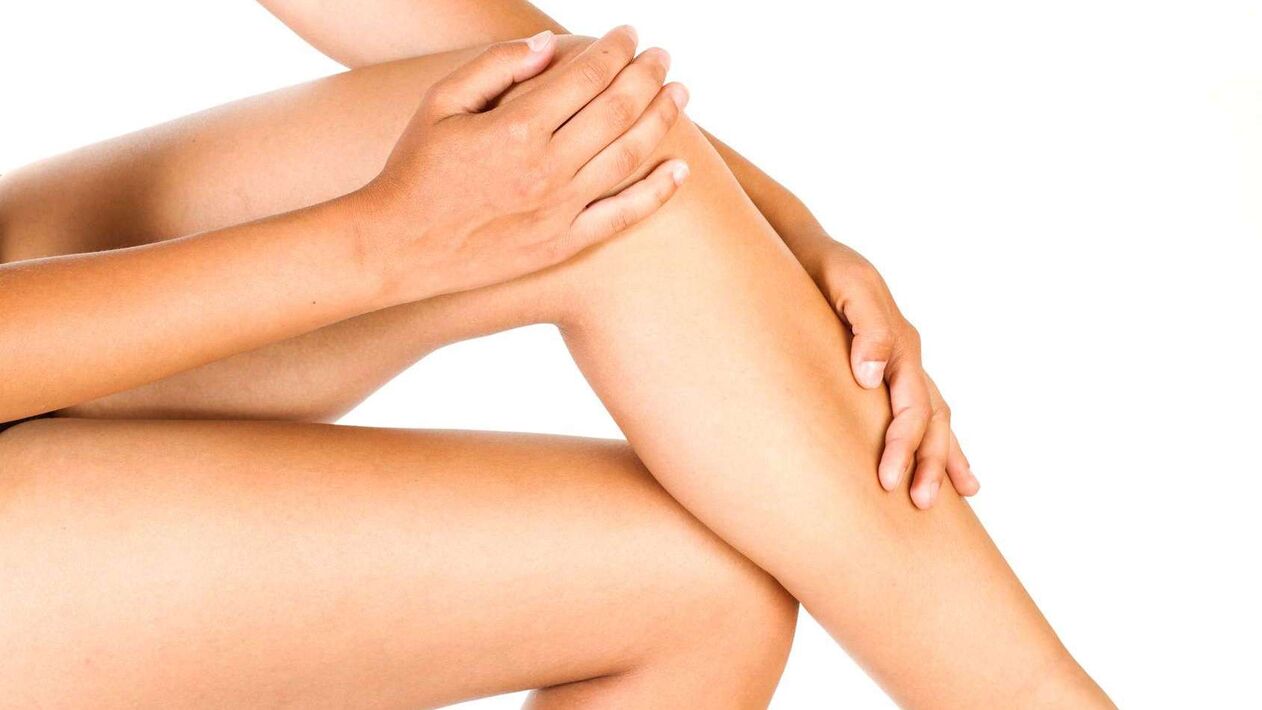 Varicose veins in women