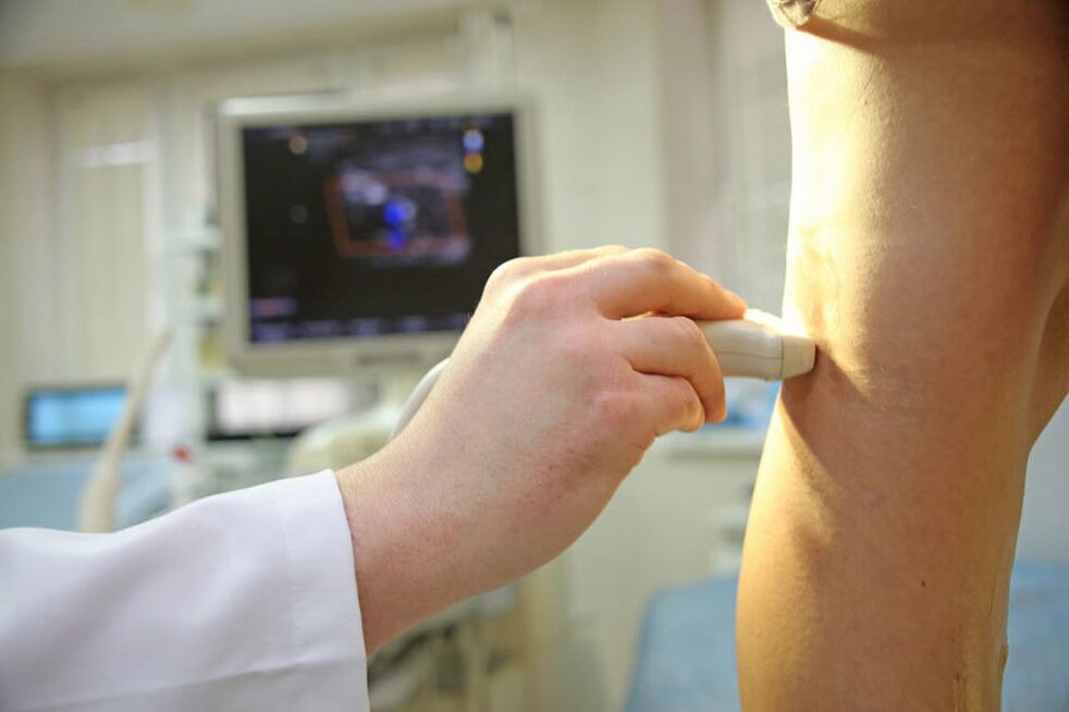 Ultrasound of the veins of the lower extremities