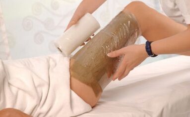 Is it possible for children to wraps for varicose veins