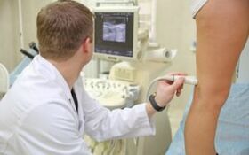Methods for the treatment of varicose veins on the legs in women